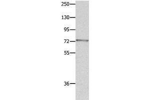 Western Blot analysis of Mouse eye tissue using MUC20 Polyclonal Antibody at dilution of 1:1400 (MUC20 anticorps)