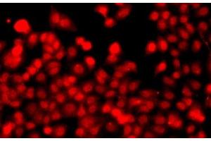 Immunofluorescence analysis of A549 cells using THAP1 Polyclonal Antibody (THAP1 anticorps)
