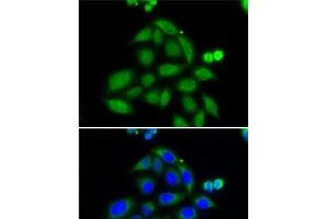 Immunofluorescence analysis of MCF7 cells using ELAC2 Polyclonal Antibody (ELAC2 anticorps)
