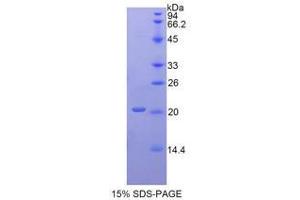 SDS-PAGE analysis of Human ACP3 Protein.