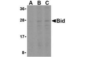 Western blot analysis of Bid in A549 cell lysates with Bid AP30148PU-N antibody at (A) 0. (BID anticorps  (Middle Region))