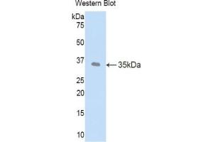 Detection of Recombinant LEFTY1, Human using Polyclonal Antibody to Left/Right Determination Factor 1 (LEFTY1) (LEFTY1 anticorps  (AA 78-361))