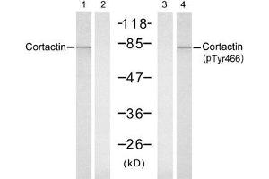 Western blot analysis of extracts from Hela cells, untreated or treated with UV (20min), using Cortactin (Ab-466) antibody (E021264, Lane 1 and 2) and Cortactin (Phospho-Tyr466) antibody (E011272, Lane 3 and 4). (Cortactin anticorps)