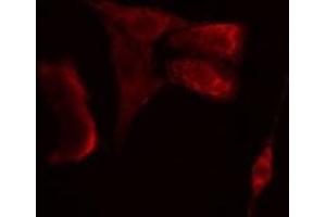 anti-RAD23 Homolog B (RAD23B) (N-Term) antibody