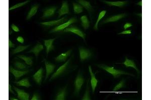 Immunofluorescence of monoclonal antibody to CCBL1 on HeLa cell. (CCBL1 anticorps  (AA 1-374))