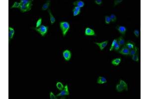 Immunofluorescence staining of HepG2 cells with ABIN7169521 at 1:266, counter-stained with DAPI. (SCOC anticorps  (AA 1-121))