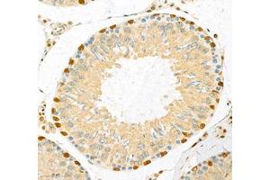 Immunohistochemistry of paraffin embedded rat testis using CUX2 (ABIN7073607) at dilution of 1:700 (300x lens) (CUX2 anticorps)