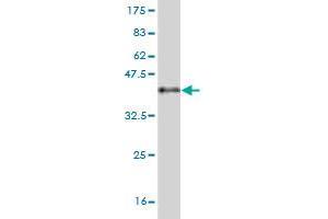 Western Blot detection against Immunogen (37. (Pleiotrophin anticorps  (AA 45-154))