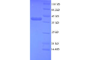 SDS-PAGE (SDS) image for Teratocarcinoma-Derived Growth Factor 1 (TDGF1) (AA 32-150), (partial) protein (GST tag) (ABIN5712754)