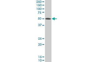 TARDBP polyclonal antibody (A01), Lot # Abnova060510QCS1 Western Blot analysis of TARDBP expression in IMR-32 .