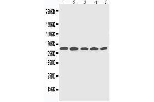 Anti-CYP2U1 antibody, Western blotting Lane 1: HELA Cell Lysate Lane 2: MCF-7 Cell Lysate Lane 3: MM453 Cell Lysate Lane 4: COLO320 Cell Lysate Lane 5:  Cell Lysate (CYP2U1 anticorps  (C-Term))