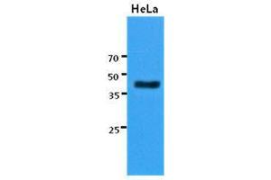 The cell lysates of HeLa (30 ug) were resolved by SDS-PAGE, transferred to PVDF membrane and probed with KRT23 antibody (1:3000).