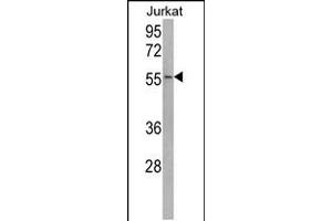 Western blot analysis of USP22 Antibody in Jurkat cell line lysates (35ug/lane)