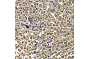 Immunohistochemistry of paraffin-embedded mouse cancer using ARID3A antibody. (ARID3A anticorps)