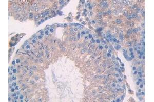 Detection of UBD in Rat Testis Tissue using Polyclonal Antibody to Ubiquitin D (UBD) (UBD anticorps  (AA 1-155))