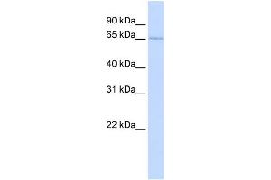 WB Suggested Anti-TKTL2 Antibody Titration:  0. (TKTL2 anticorps  (N-Term))