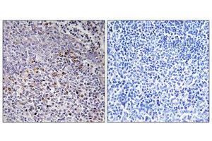 Immunohistochemistry analysis of paraffin-embedded human tonsil tissue using Cytochrome c-type Heme Lyase antibody. (HCCS anticorps  (Internal Region))