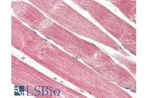 ABIN5539898 (5µg/ml) staining of paraffin embedded Human Skeletal Muscle. (THNSL2 anticorps  (Internal Region))