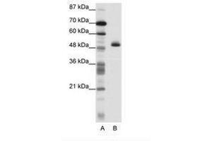 Image no. 1 for anti-Zinc Finger Protein 213 (ZNF213) (N-Term) antibody (ABIN202568) (ZNF213 anticorps  (N-Term))
