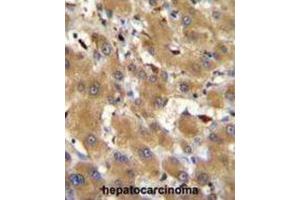 Immunohistochemistry (IHC) image for anti-Haptoglobin Related Protein (HPR) antibody (ABIN2996022) (HPR anticorps)