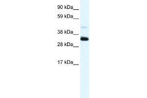 WB Suggested Anti-ANXA3 Antibody Titration:  1. (Annexin A3 anticorps  (N-Term))