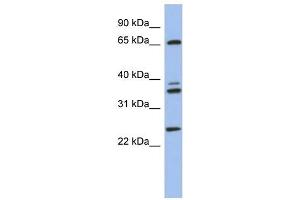 ATP6V1A antibody used at 1 ug/ml to detect target protein. (ATP6V1A anticorps  (N-Term))