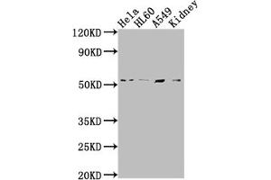 Western Blot Positive WB detected in: Hela whole cell lysate, HL60 whole cell lysate, A549 whole cell lysate, Mouse kidney tissue All lanes: ILK antibody at 1:2000 Secondary Goat polyclonal to rabbit IgG at 1/50000 dilution Predicted band size: 52, 45, 37 kDa Observed band size: 51 kDa