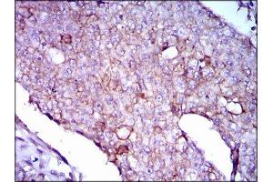 Immunohistochemistry (IHC) image for anti-Lipoprotein (Lp(a)) (AA 4330-4521) antibody (ABIN1845714) (Lp(a) anticorps  (AA 4330-4521))