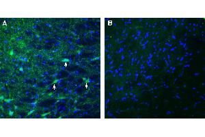 Expression of MEGF10 in rat substantia nigra. (MEGF10 anticorps  (Extracellular))