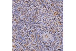 IHC analysis of ITK using anti-ITK antibody (ABIN7601855).