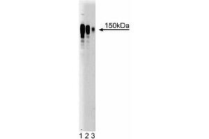 Western blot analysis of Ataxin-2 on Jurkat cell lysate (left). (Ataxin 2 anticorps  (AA 713-904))