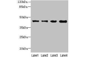 Western blot All lanes: KCTD9 antibody at 8 μg/mL Lane 1: MCF-7 whole cell lysate Lane 2: HepG2 whole cell lysate Lane 3: HT29 whole cell lysate Lane 4: U251 whole cell lysate Secondary Goat polyclonal to rabbit IgG at 1/10000 dilution Predicted band size: 43 kDa Observed band size: 43 kDa (KCTD9 anticorps  (AA 1-200))