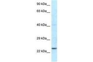 Image no. 1 for anti-Ring Finger Protein 141 (RNF141) (N-Term) antibody (ABIN6747518)