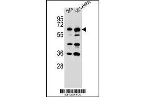Western blot analysis in 293,NCI-H460 cell line lysates (35ug/lane). (CKAP4 anticorps  (C-Term))