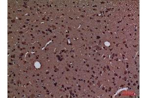 Immunohistochemistry (IHC) analysis of paraffin-embedded Rat Brain, antibody was diluted at 1:100. (PPIA anticorps  (Internal Region))
