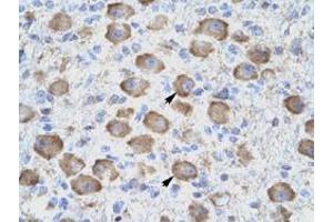 Immunohistochemical staining (Formalin-fixed paraffin-embedded sections) of human brain with TNFRSF18 polyclonal antibody  at 4-8 ug/mL working concentration.