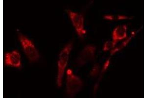 ABIN6278264 staining NIH-3T3  cells by IF/ICC. (LGALS8 anticorps  (Internal Region))