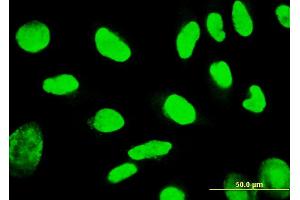 Immunofluorescence of monoclonal antibody to TSPYL1 on HeLa cell.