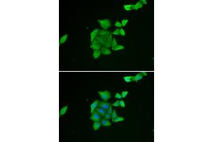 Immunofluorescence analysis of U2OS cell using TUSC2 antibody. (TUSC2 anticorps)