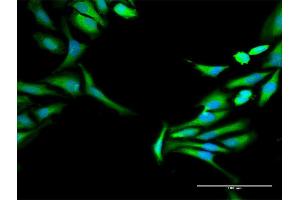 Immunofluorescence of purified MaxPab antibody to HOMER1 on HeLa cell.