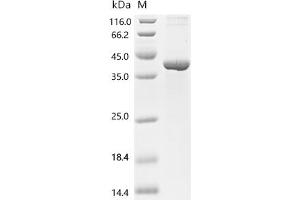 (Tris-Glycine gel) Discontinuous SDS-PAGE (reduced) with 5 % enrichment gel and 15 % separation gel.