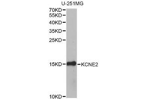 Western blot analysis of extracts of U-251MG cells, using KCNE2 antibody. (KCNE2 anticorps)