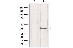 Western blot analysis of extracts from HepG2, using C/EBP-beta Antibody.