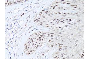 Immunohistochemistry of paraffin-embedded human skin using TP63 antibody (ABIN5971164) at dilution of 1:50 (40x lens). (p63 anticorps)