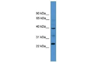 BTNL8 antibody used at 0. (BTNL8 anticorps  (Middle Region))