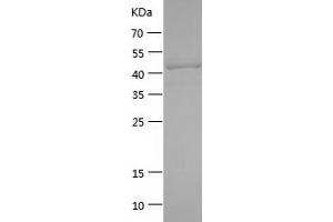 Western Blotting (WB) image for Lymphocyte-Activation Gene 3 (LAG3) (AA 23-222) protein (His-IF2DI Tag) (ABIN7123802)