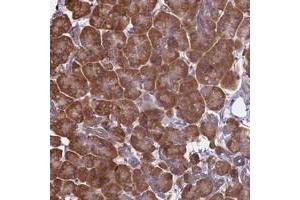 Immunohistochemical staining of human pancreas with KIAA1143 polyclonal antibody  shows strong cytoplasmic positivity in exocrine glandular cells at 1:1000-1:2500 dilution. (KIAA1143 anticorps)