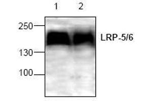 Image no. 1 for anti-Low Density Lipoprotein Receptor-Related Protein 5 (LRP5) antibody (ABIN127323)