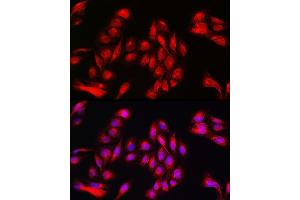 Immunofluorescence analysis of U2OS cells using Annexin  Rabbit pAb (ABIN6127436, ABIN6136920, ABIN6136921 and ABIN6223291) at dilution of 1:50 (40x lens).