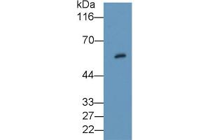 Detection of PKBb in Rat Thyroid lysate using Polyclonal Antibody to Protein Kinase B Beta (PKBb) (AKT2 anticorps  (AA 142-412))